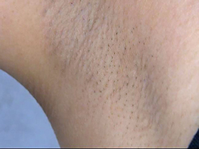 300人の腋 2　サンプル画像16